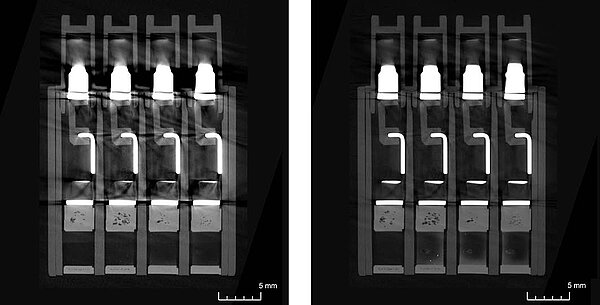 多材料伪影校正– 下一代产品的精度